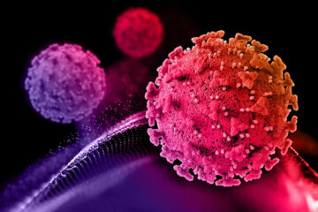 Other Cancers Spreading to Bone (Metastasis)